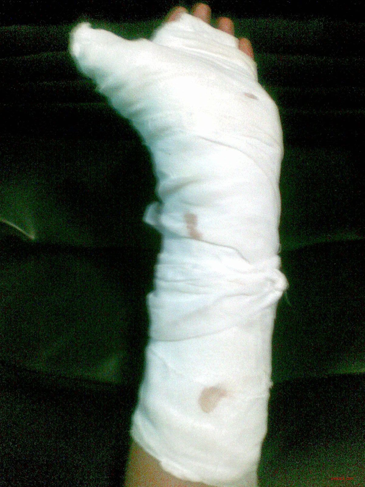 dvubb 图片点击可在新窗口打开查看